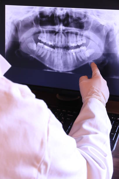 Best Emergency Dental Care for Broken or Chipped Teeth in Kyle, SD