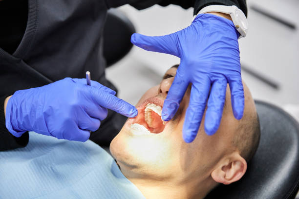 Best Urgent Care for Lost Fillings or Crowns in Kyle, SD